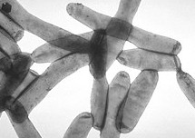 Legionella pneumophila – Warto przeczytać!